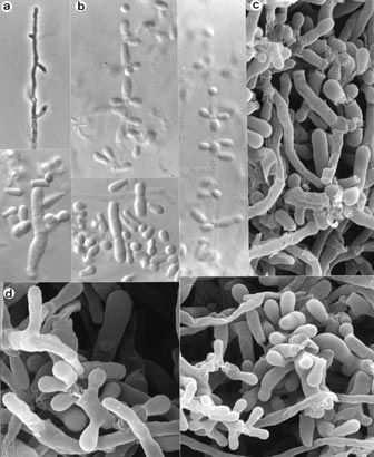 Trichophyton violaceum sporulace chybí nebo redukovaná (thiamin podporuje tvorbu konidií) hyfy reflexivně větvené, hustě septované, často se