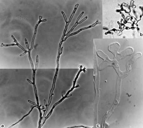 Trichophyton schoenleinii kolonie voskovité, později sametové, vyvýšené, bělavé, šedobílé až krémové reverz bez