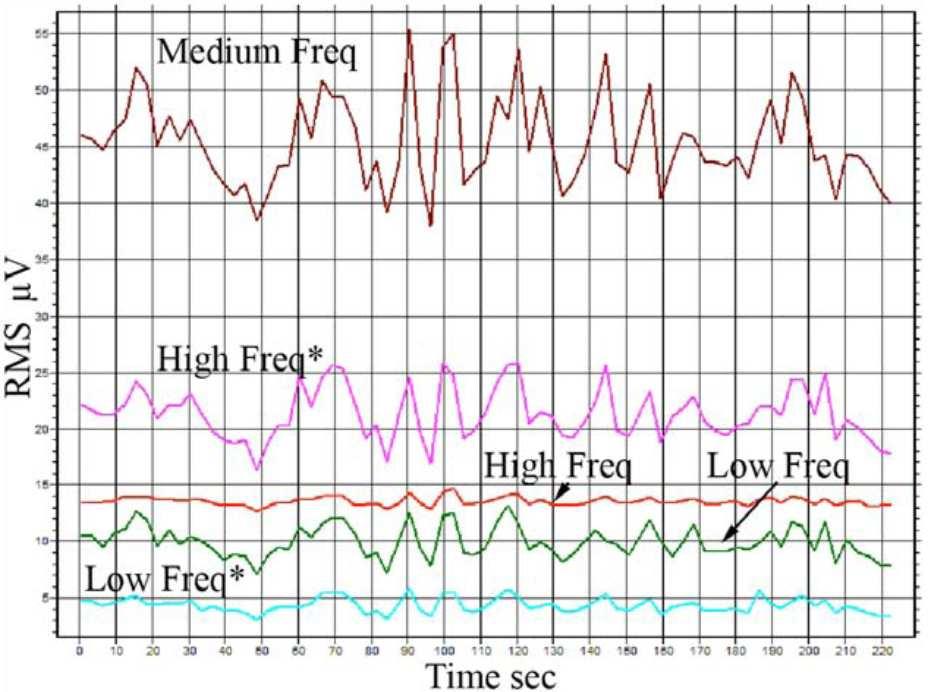 Výsledky a diskuze Aktivita AE testovaných ložisek byla sledována parametry Hits, Counts, Duration, Energy a RMS.