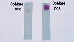 Příklady dalších testů: oxidázový test