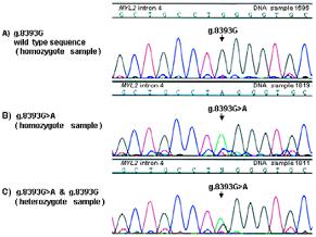 SNPs Metody detekce SNPs SNP = single nucleotide polymorphism jednonukleotidové variace, které jsou náhodně rozmístěny v genomu (bodové mutace rozšířené v populaci) nukleotidová variace, která se