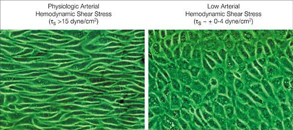 Endotel Změna morfologie endoteliálních buněk po expozici fyziologickým a nízkým hodnotám smykového napětí - změna exprese genů
