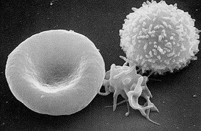 5600 ml) Plazma + krevní partikule leukocyty, trombobyty,