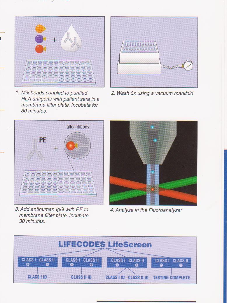 Detekce anti-hla protilátek metodou Luminex Barevně