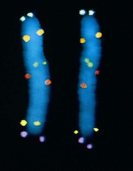 Použití hybridizace in situ pro detekci genů na chromosomech