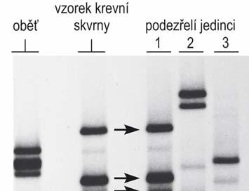 Soudní vyšetřování profil DNA