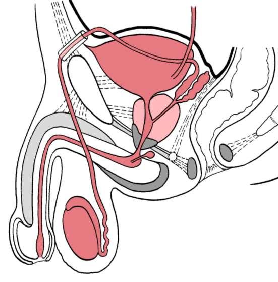 Mužské pohlavní orgány organa genitalia masculina varle - testis (orchis) nadvarle - epididymis chámovod ductus deferens