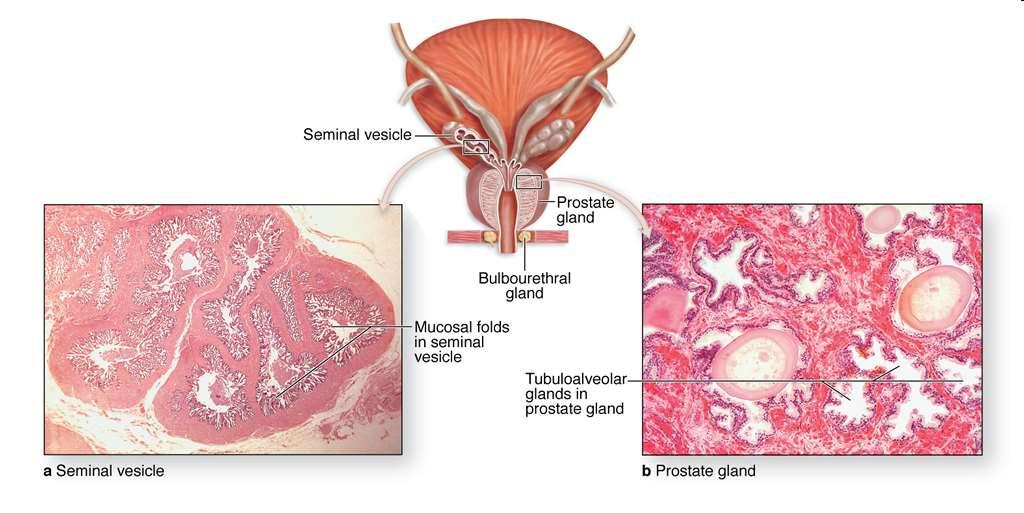 Parenchyme of the prostate: dense