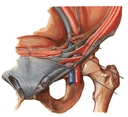 CANALIS INGUINALIS Superior wall: M.