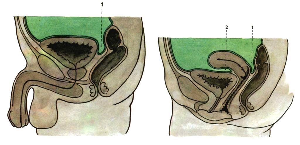 Median section through the male pelvis