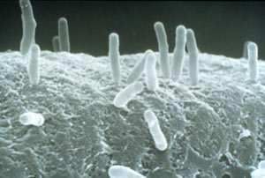 Ti plazmid Agrobacterium tumefaciens T-DNA obsahuje cca 8 genů, které se v hostitelské rostlinné buňce