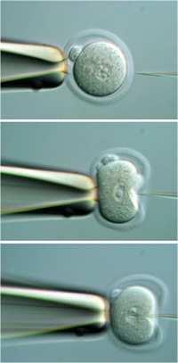 Klonování DNA bez vektoru nejefektivnějším přenosem do savčích buněk je mikroinjekce plazmidová nebo lineární DNA mikroinjikovaná do jádra savčích buněk se začleňuje do chromozomu mikroinjekce do