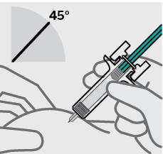 Přípravek Tremfya předplněná injekční stříkačka nepoužívejte, pokud Vám upadla. Spojte se se svým lékařem nebo lékárníkem a požádejte je o jinou.