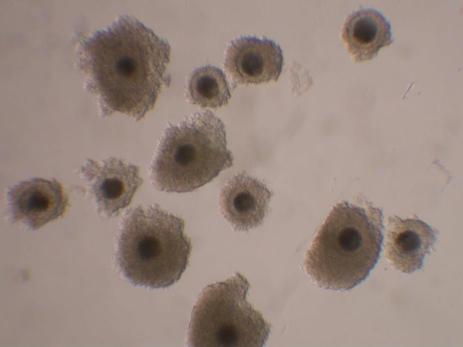 zdravým kumulem čítajícím nejméně dvě vrstvy kumulárních buněk s tmavou nebo lehce granulovanou cytoplasmou (Obr.2). Obr. 2: Vyselektované ocyty s kompaktním kumulem a tmavou homogenní cytoplasmou.