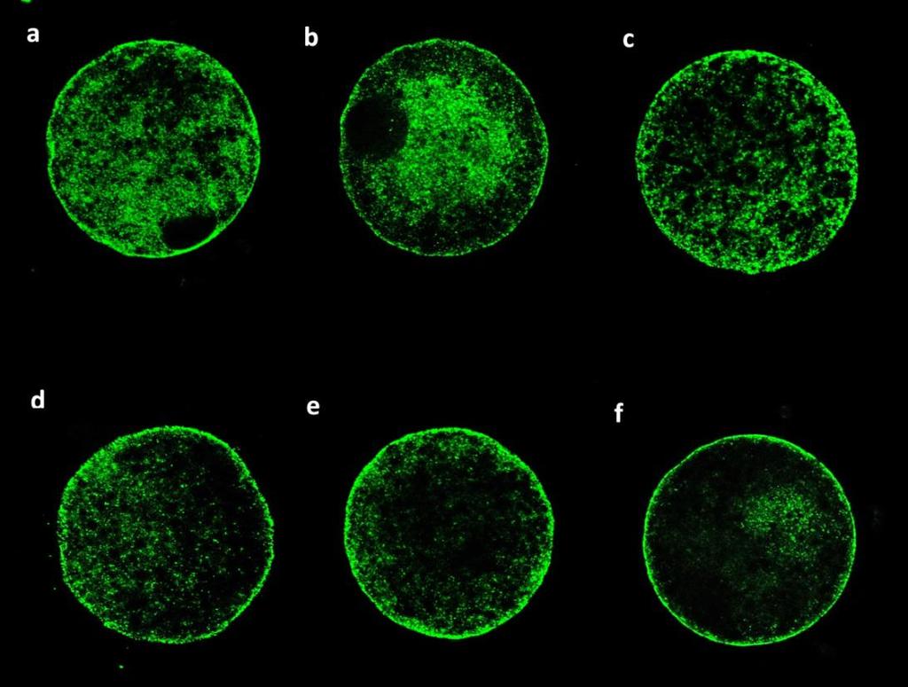 Obr. 6: Optické řezy z konfokálního mikroskopu zachycující kortikální granula oocytů v jednotlivých fázích estrálního cyklu (a: časná luteální fáze 1-5 den cyklu; b: střední luteální fáze 6-10 den