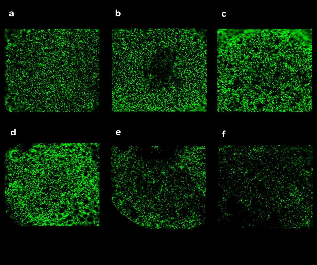 Obr. 10: Optické řezy apikálního pólu oocytů zachycující denzitu kortikálních granul na periferii v jednotlivých fázích estrálního cyklu (a: časná luteální fáze 1-5 den cyklu; b: střední luteální