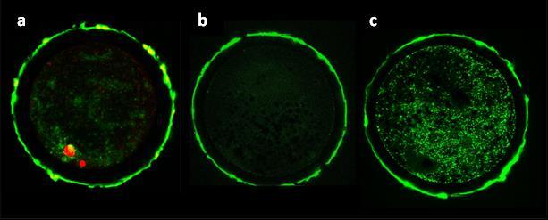 Tab. 5: Distribuce kortikálních granul za 18 h po fertilizaci oocytů získaných z malých a středních folikulů Fertilizované oocyty Velikost folikulů Počet vyšetřených oocytů Počet CGs / 100µm 2 (mean