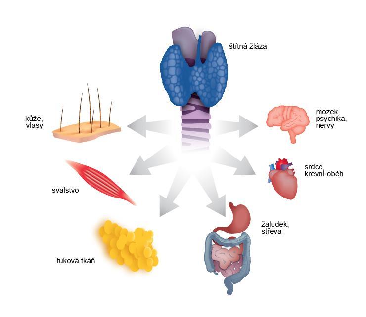 žlázy vede k rozvoji hypertyreózy a je nejčastějším důsledkem tzv.