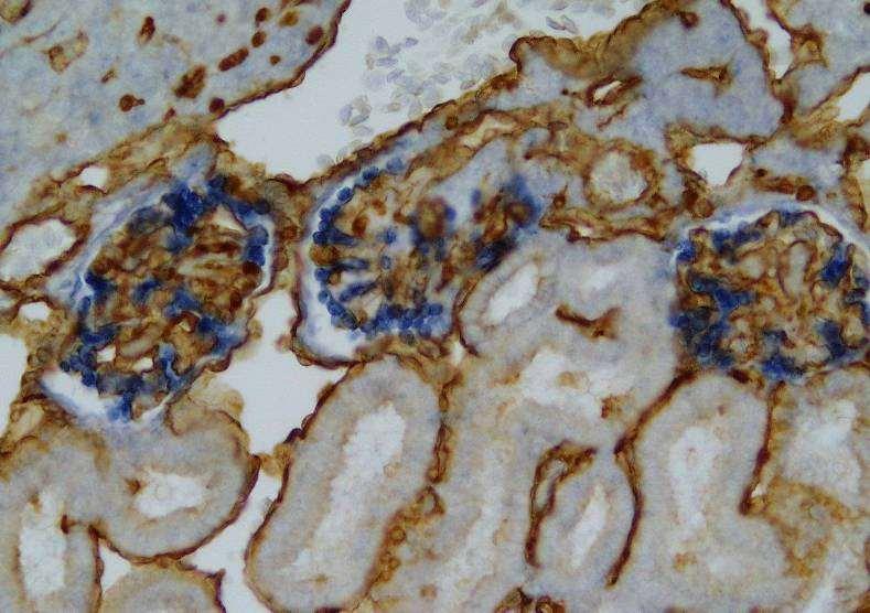 In situ hybridizace (ISH) mrna VEGF v řezech (modře) v