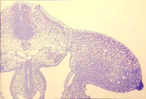 Frontální řez embryem kuřete 5.