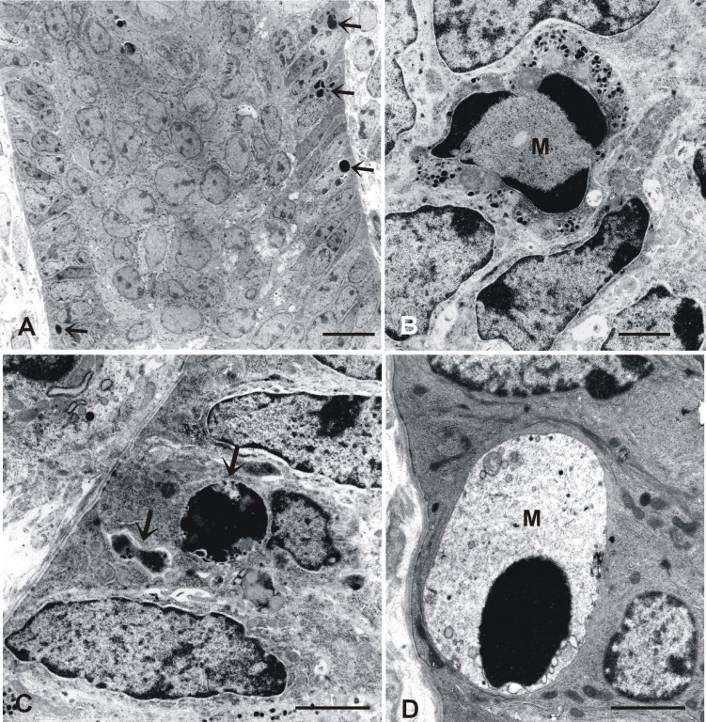 Apoptosis