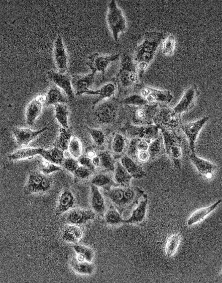 lidské ledvinové buňky lidské T-lymfocyty Vero cell