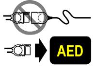 Bezpečnost Defibrilační elektrody pro batolata/děti se sníženou energií nejsou kompatibilní s defibrilačními a terapeutickými kabely QUIK-COMBO.
