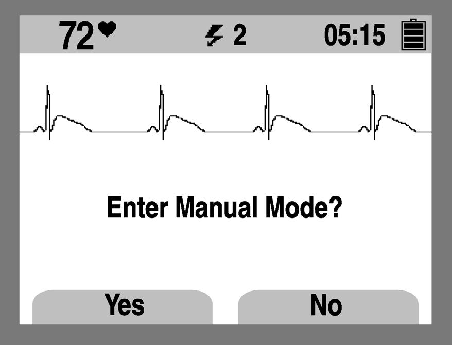 Ovládací prvky a indikátory Indikátor výboje Indikátor srdeční frekvence Oblast zpráv Symbol stavu baterie Uplynulý čas EKG Výzvy Tlačítka Přejít do manuálního režimu?