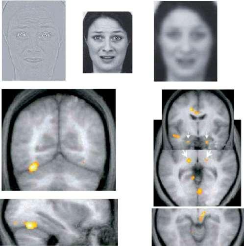 Reakce na vyděšený obličej Ostrý g. fusiformis Neostrý Th-CS-amygdala A B Aktivita při pozorování tváří. A)vysoké rozlišení ; B, nízké rozlišení.