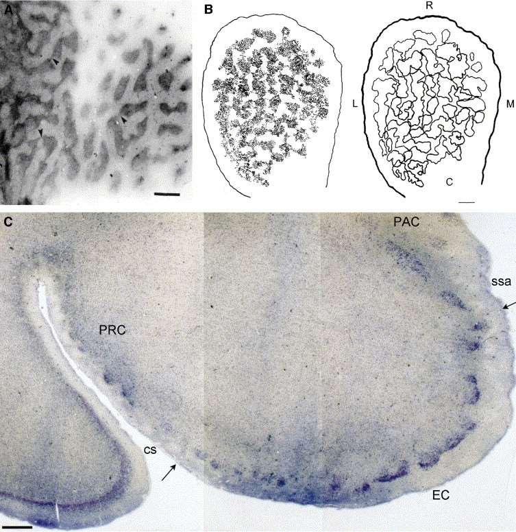 Ostrůvky buněk v area 28 podmiňující zvenčí viditelné verrucae areae entorhinalis Buňky jako první odumírají během stárnutí a u AD, Negativní korelace mezi věkem a velikostí oblasti s verrukami
