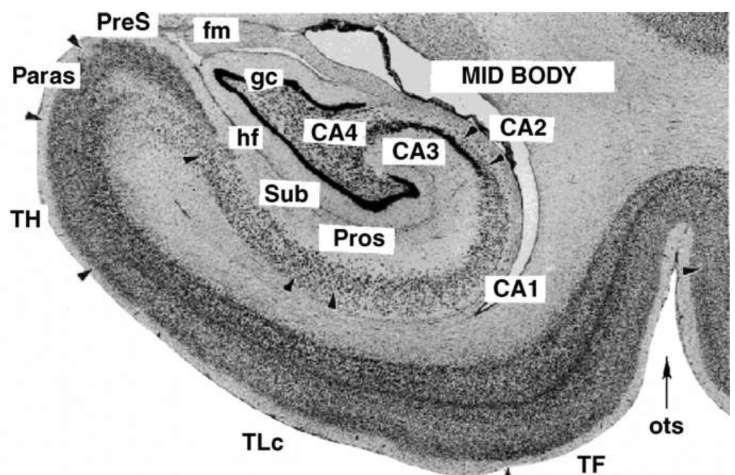Části archikortexu a periarchikortexu na frontálním řezu mozkem opice E.T. Rolls / Behavioural Brain Research 17