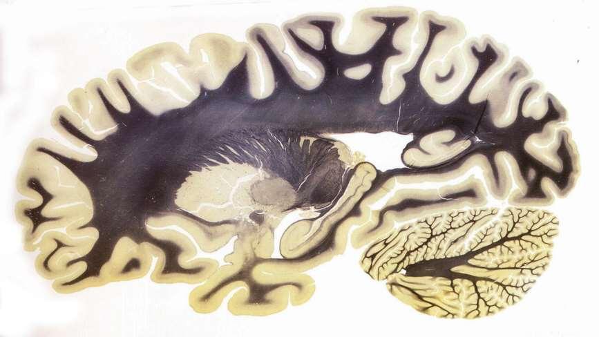 Sagitální řez mozkem barvený