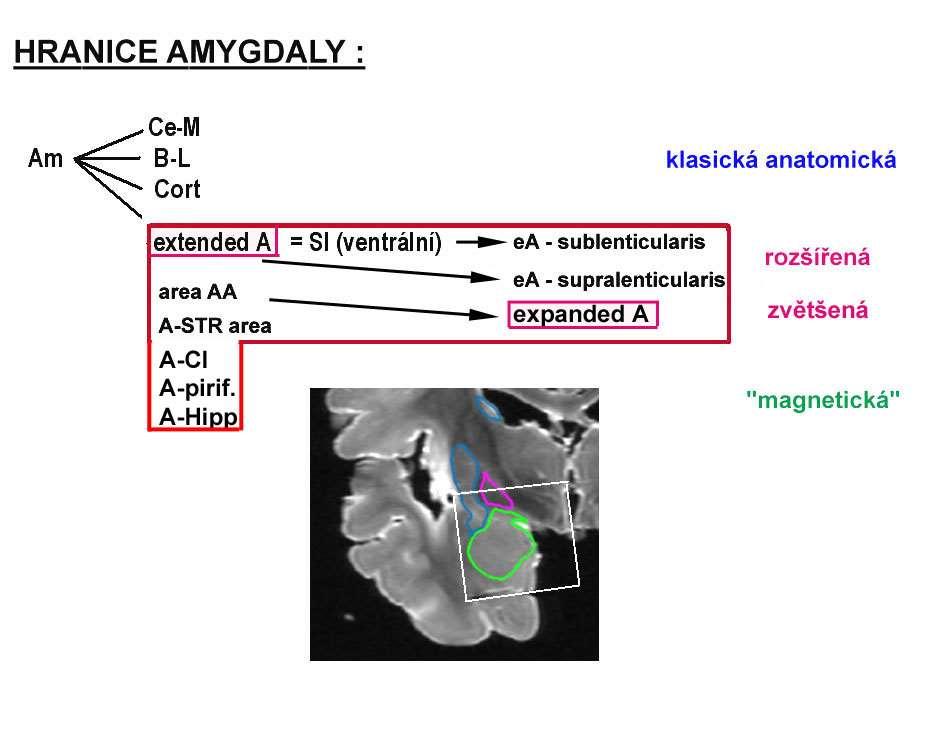 Klasická anatomická extended amygdala SI - ventrální - sublentikulární Rozšířená
