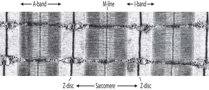 MYOFIBRILY KARDIOMYOCYTŮ Aktinová a myozinová myofilamenta Sarkomera Z-linie