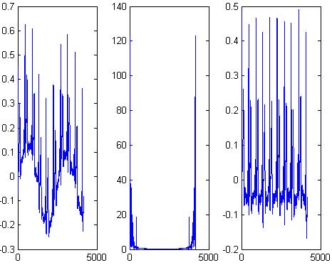 Příklady filtrace Superponování EKG signálu