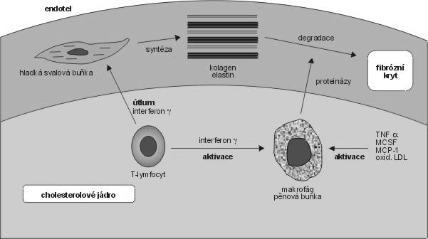 Obr. 6 Zjednodušené schéma tvorby a degradace fibrózního krytu aterosklerotického plátu[1] 3.
