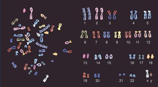 Klasické metody vyšetření Karyotyp je soubor všech chromosomů v jádřě buňky.