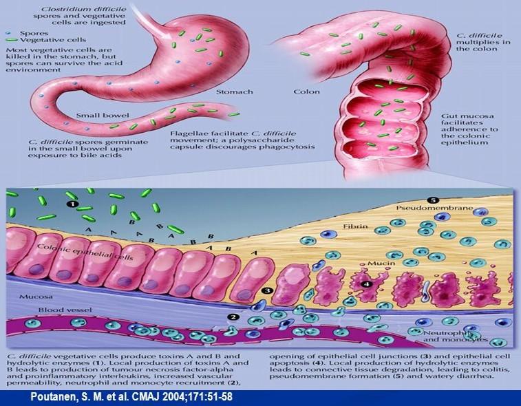 Clostridium