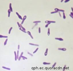 Clostridium tetani G+ tyčka, anaerobní, rovné, štíhlé, terminální endospora ( paličky na buben ) saprofyt savců (zejména koní) původce tetanu (vstupní branou obvykle hlubší znečištěné rány, méně