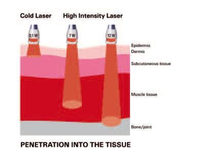 13 Vlnová délka a výkon laseru ovlivňuje hloubku průniku záření. Vlnové délky 810/980 nm a 1064 nm jsou specifické vysokým účinkem na chromofory.