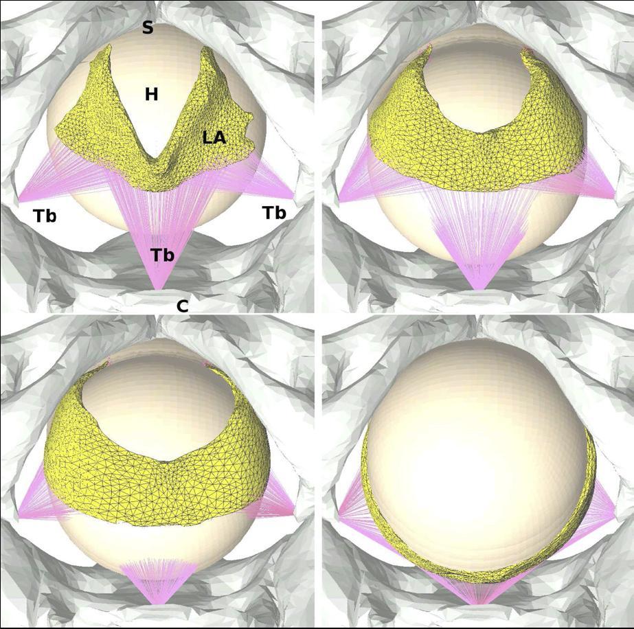 Obrázek 3 Simulovaný model m. LA (Hoyte aj., 2008) Legenda k obrázku 3: Axiální pohled na m. LA během simulovaného porodu. H - hlavička plodu, LA - m. LA, C - kostrč, S- symfýza, Tb - úpony m. LA. Weidner aj.