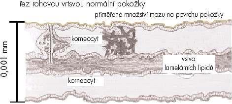 2 Typologie pleti 2.1 Normální pleť Tento typ pleti je dá se říct typem ideálním. Pleť je na pohled i dotyk hebká, pružná bez zvětšených pórů a je růžová.