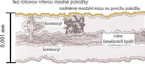 2.3 Smíšená pleť Smíšená pleť je nejčastějším typem pleti. Charakteristická zvýšená tvorba mazu v oblasti T- zóny, naopak na tvářích, okolo úst a v oblasti očí má sklon k vysušování.