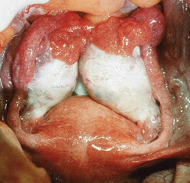 OVARIUM Extremitas tubaria et uterina Lig. suspensorium ovarii Lig.