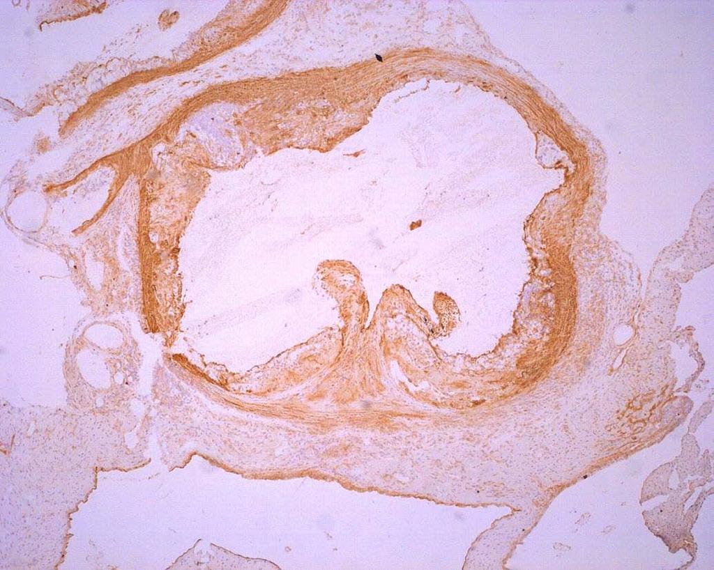 Obr. 14 Imunohistochemické barvení VCAM-1 u kontrolní skupiny zvířat (A).