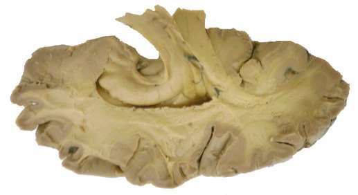 Archikortex 1) cornu Amonis = hippocampus (hipokampální formace) 2) subiculum = horní