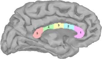 MRI u bipolární poruchy (maniodepresivní) U bipolární poruchy menší části 2,3,4 oproti zdravým i oproti depresivním Žádný vztah velikosti a sebevražedných pokusů Corpus callosum volumes in bipolar