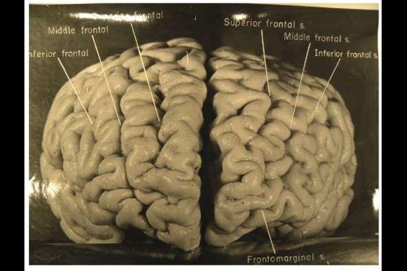 Einstein s brain Nature News Snapshots explore Einstein s unusual brain Photos reveal unique features of genius s cerebral cortex.
