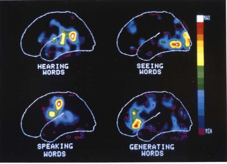 PET FIGURE 7. PET scan showing the localization of selected cognitive functions in the cerebral cortex. PECHURA, C.M. & J.B. MARTIN, Eds.