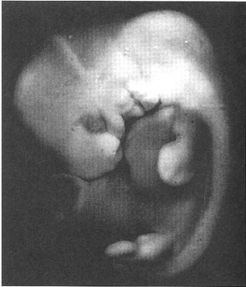 2.2 Vývoj horní končetiny Vývoj horní končetiny v embryonálním stadiu je velmi odlišný od vývoje končetiny dolní, ale obě jsou původně výchlipkami embryonální tělní stěny, která se skládá z